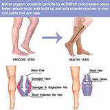 2 Pairs Black Open-Toed Leg Stocking with Zipper(20-30mmHg) -Toeless Calf Compression Sleeves